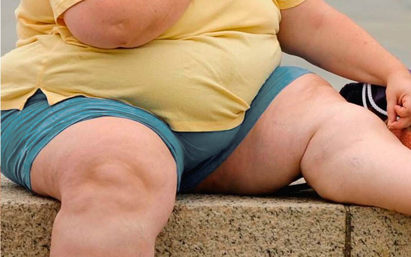Роль ожирения в поздних осложнениях диабета